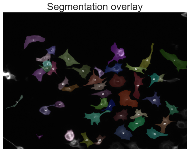 ../../_images/56360e384b25d9428baf081d9635307c023b20e73f158e690cd20a36f58c9666.png